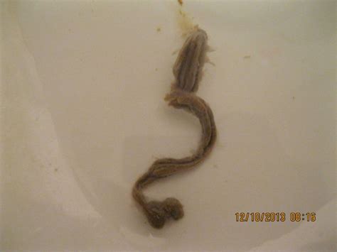 need identity of intestinal parasite image 6 on curezone image gallery