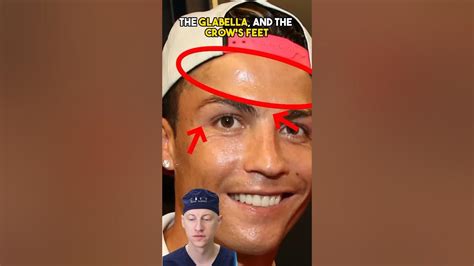 Cristiano Ronaldo Had Plastic Surgery Youtube