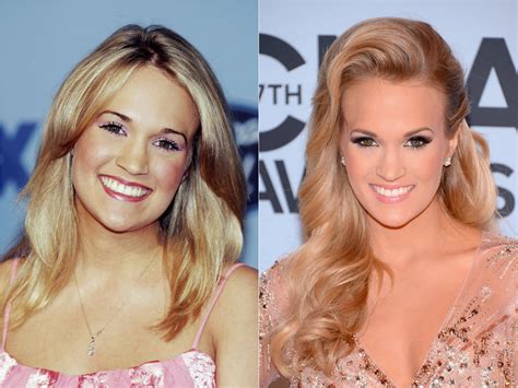 Carrie Underwood Before And After Plastic Surgery Including Nose Job