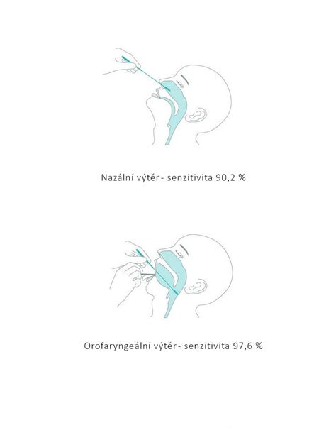 You can request further information material such as product. Antigenní test tyčinkový, NADAL® COVID-19 Ag Test ...