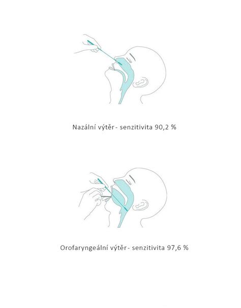 © dieses dokument ist geistiges eigentum der nal von minden gmbh. Antigenní test tyčinkový, NADAL® COVID-19 Ag Test ...