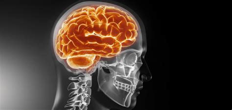 Is There A Link Between Traumatic Brain Injury And Dementia Neuro