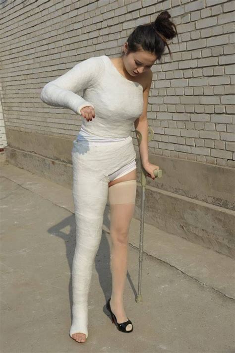 Фотографии Екатерины Дороховой leg cast body cast it cast