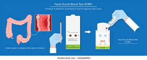 Blood Stool Test Stools Item