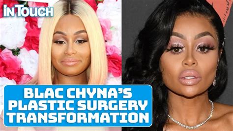 blac chyna s plastic surgery transformation youtube