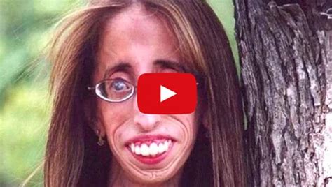 bullies called her world s ugliest woman and now she is an inspiration must watch video