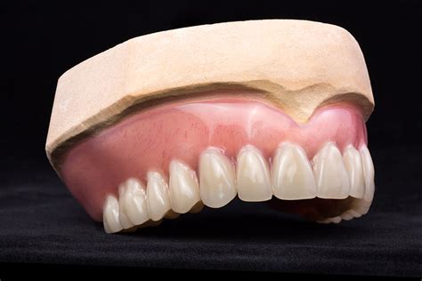 Modern Cosmetic Dentures Toothstation Cambridge Toothstation