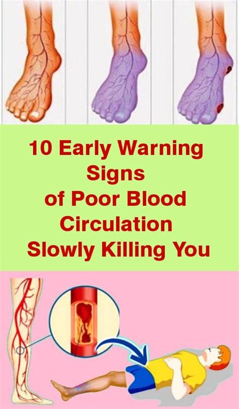 10 Early Warning Signs Of Poor Blood Circulation Slowly Killing You