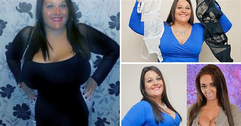 Josie Cunningham Mum With Kk Bust Gets Free Breast Reduction From Sympathetic Surgeon After Nhs