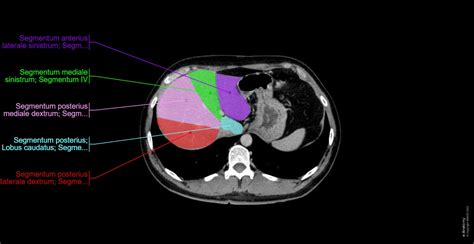 Lymphknotenbereiche Normale Anatomie E Anatomy