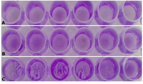 Crystal Violet Assay To See The Formation Of Biofilm A Polymicrobial