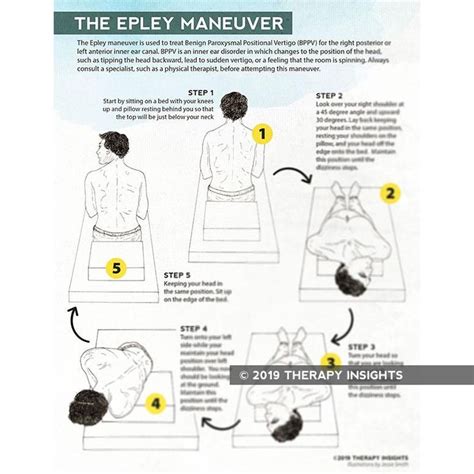 Handout Visualizing The Epley Maneuver Epley Maneuver Vertigo