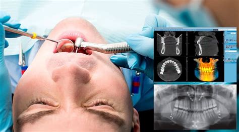 Cirugía Dental Tipos Y Precios Clínica Dental Tacna