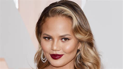 Chrissy Teigen Shows Surgery Scars In Revealing Selfie