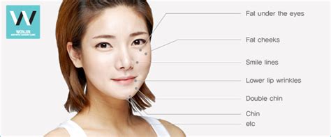 This is a good buy for me. How to get a V line face - Acculifting