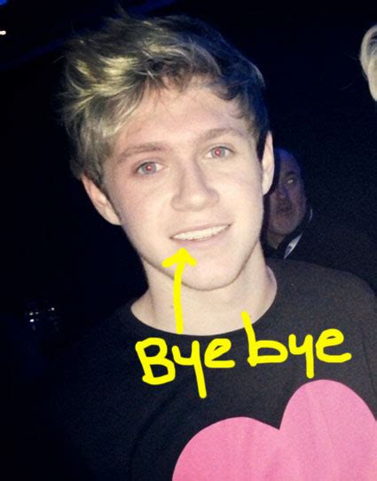 Niall Horan Shows Off His New Teeth After Having His Braces Removed Pics