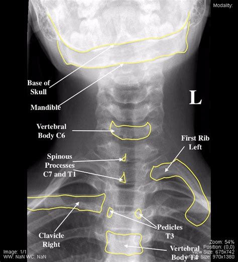 171 Head And Neck Medicine Libretexts