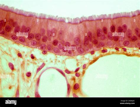 Trachea Epithelium Light Micrograph Of A Vertical Section Through The