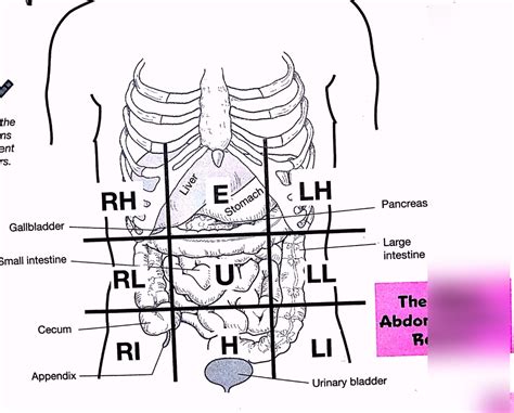 Abdominopelvic Quadrants And Regions Diagram Quizlet