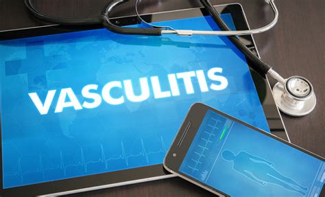 What Is Vasculitis Mya Care