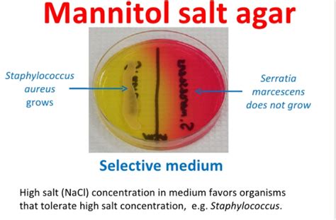 Mannitol Salt Agar Msa Test Scientist Cindy