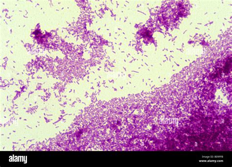 Mycobacterium Tuberculosis Microscope