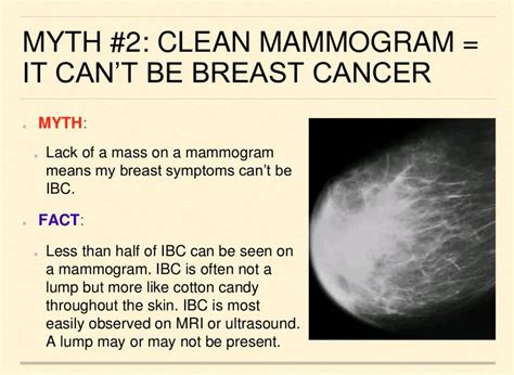 Inflammatory Breast Cancer Ultrasound