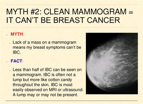 inflammatory breast cancer ultrasound