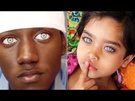 Rarest Eye Colors In Humans Yt Mp Convert
