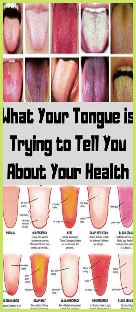 What Your Tongue Is Trying To Tell You About Your Health Healthy B