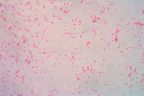 Gram Negative Diplococci Intracellular Stock Image Image Of