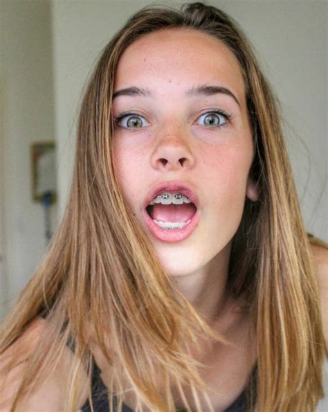 Pin By Giraffes On Mouth Open Cute Braces Cute Girls With Braces