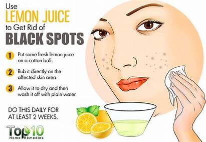Lemon Spots Dark Face Remedies Juice Rid