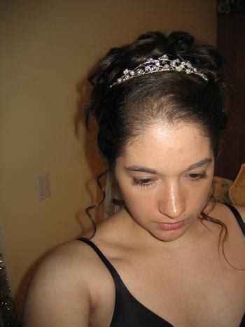 For hair that is thinning at the top of the scalp, a hair topper can be a lifesaver as they are designed to target as conceal partial hair loss. Brides Helping Brides ™ - Question for girls with very ...