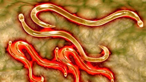 4 Signs Youre Infected With A Parasite Howstuffworks