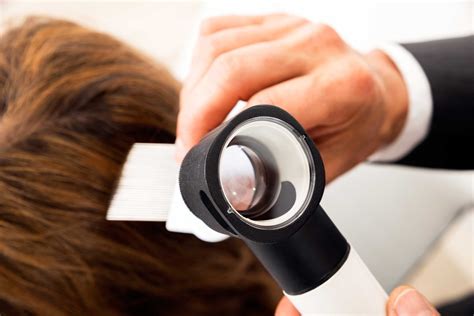 How To Prevent Hair Loss In Men The Healthy