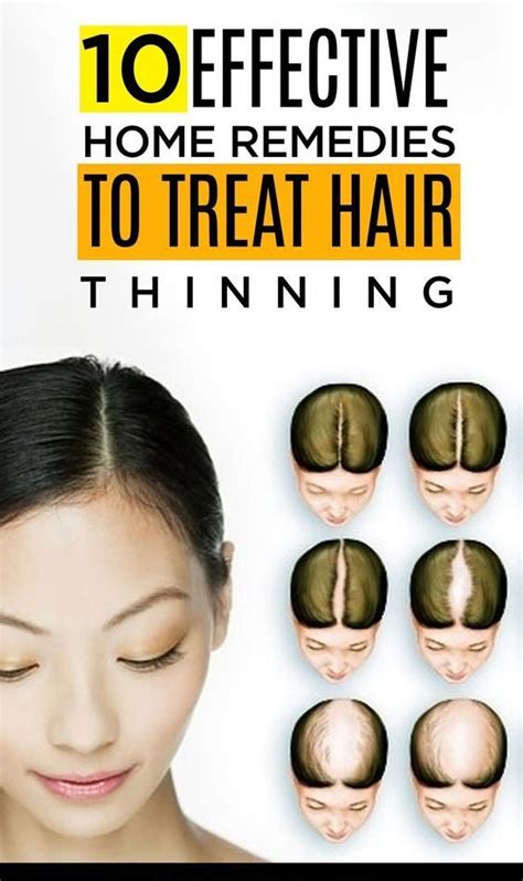 How To Stop My Hair From Thinning And Falling Out Male Tips And Tricks
