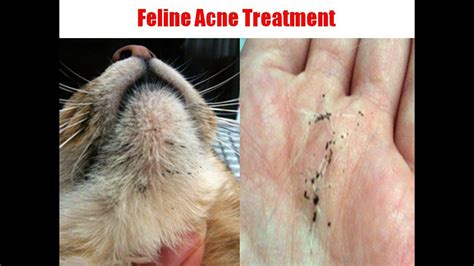 Pin By Dinding 3d On Pet Chin Acne Treatment Cystic Acne Treatment