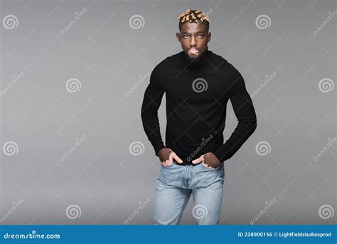 African American Man With Vitiligo Posing Stock Photo Image Of Black
