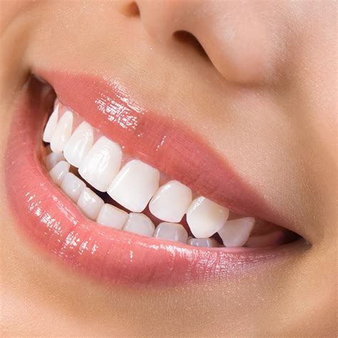Fix Teeth With Cosmetic Veneers For Teeth London On