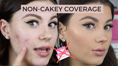 How To Cover Acne Non Cakey Youtube