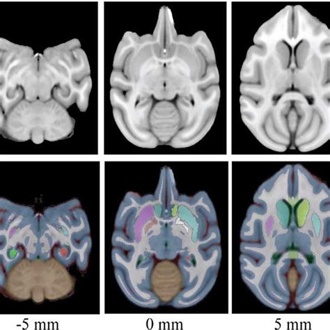 Pdf Digital Atlas Of The Rhesus Monkey Brain In Stereotaxic Coordinates