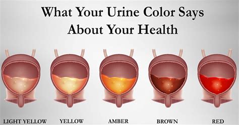 This color in the interiors, on the catwalks and in cosmetics. Learn What The Color Of Your Urine Means | Pee color ...