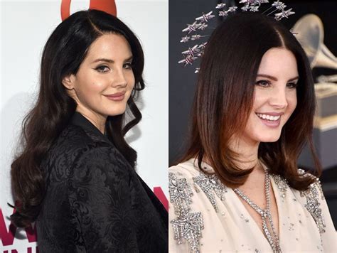 Lana Del Rey Plastic Surgery | Pics Holder Collector of ...