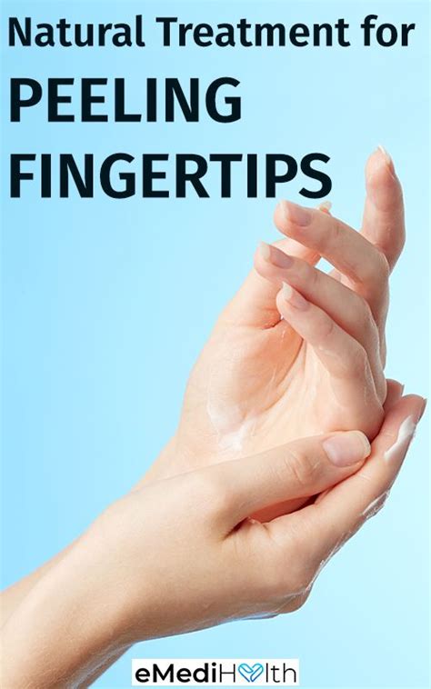 Peeling Fingertips Causes Home Remedies And Prevention Tips
