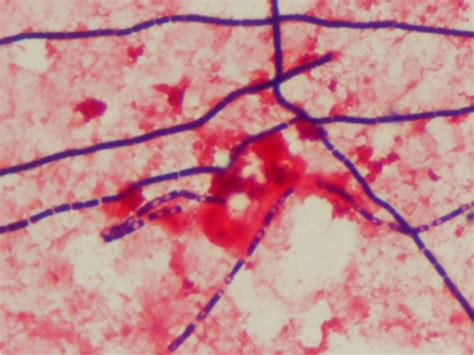 Gram Stain Of B Anthracis Showing Large Gram Positive Open I