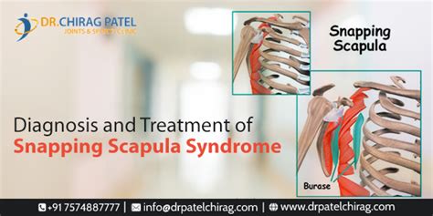 Is Snapping Scapula Syndrome Dangerous