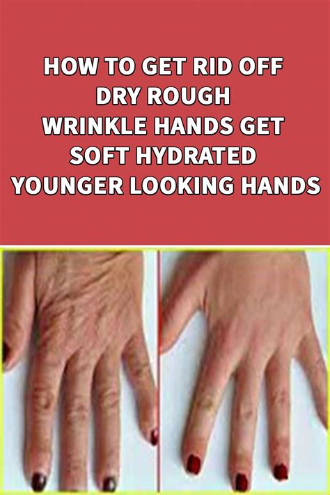 HOW TO GET RID OFF DRY ROUGH WRINKLE HANDS GET SOFT HYDRATED BabeER LOOKING HANDS Wrinkles