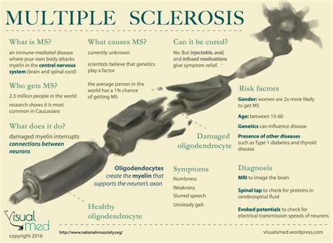 Multiple Sclerosis Visualxmed