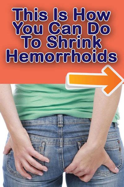 How To Shrink Hemorrhoids Fast At Home For Internal External